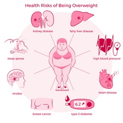 Health Risks of Being Overweight Set.  Medicine, pathology, anatomy, physiology, health. Vector illustration. Healthcare poster or banner template.