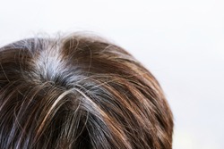 Back view of young people premature gray hair, showing black hoary hair roots on head change to senior old man.