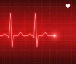 Heart pulse, electrocardiogram