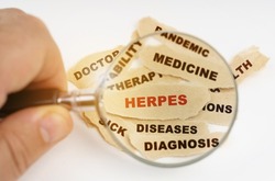 Medical concept. A man looks through a magnifying glass at scraps of paper with medical inscriptions, in the middle there is a red inscription - HERPES