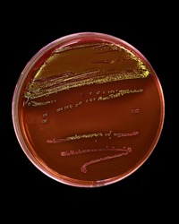 An agar plate being examined for E. coli.