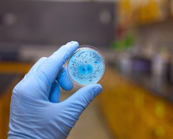 Bacteria growing on a petri dish.