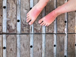 closeup sunburned feet of a woman standing on wooden surface