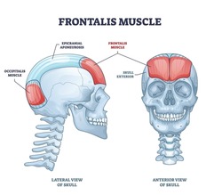 Frontalis muscle with human head facial muscular system outline diagram. Labeled educational medical scheme with anatomical skull epicranial aponeurosis and occipitalis location vector illustration.