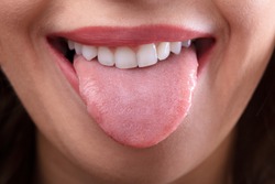 Close-up Of A Woman's Face Showing Her Clean Tongue