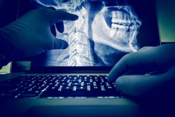 Doctor Examining Spine and Head X Ray Scan Images on His Laptop Computer. Medical Application for X-Ray Display and Examination. Radiology Theme.