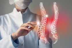 Female doctor touches virtual Spine in hand. Blurred photo, handrawn human organ, highlighted red as symbol of disease. Healthcare hospital service concept stock photo