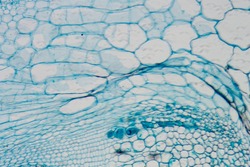 stem of pumpkin micrograph, magnification 400X