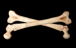 Crossbones made of two human bones on a black background