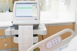 Fetal monitor with Printing of cardiogram by Electrocardiograph. Graph recording of cardiogram from Electronic fetal monitor use for heartbeat examination. Pregnancy care technology concept.