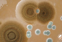 Macro mold colonies growing on an agar plates.