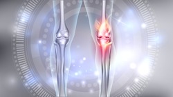 Joint problems bright abstract 3d illustration, burning damaged knee 