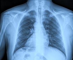 Medical X-rays