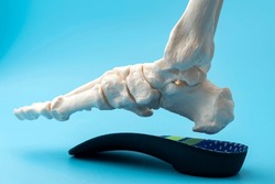 Anatomical model of the bones of the human foot wearing an orthopedic insole concept for Metatarsal health and treatment, Posture correction methods and Skeletal alignment improvement