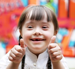 Portrait of beautiful disabled girl that giving thumbs up.