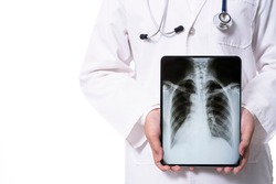 doctor holding tablet computer with x ray film image