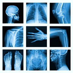 Collage of many X-rays. Very good quality / Many others X-ray images in my portfolio. 