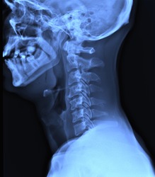 x-ray of the neck  / Many others X-ray images in my portfolio.