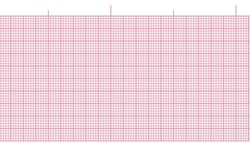 Pink blank ekg paper seamless background for heart beat rate recording. Digital ecg diagram hospital page. Millimeter graph vector grid. Geometric pattern for medicine, science line scale measurement