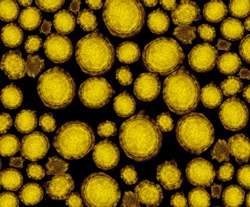 detail of ultraestructure of deadly coronavirus particles under transmission electron microscopy (TEM)