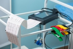 Close-up photo of an electrocardiograph printing out the results of a cardiogram during a doctor's appointment at the clinic