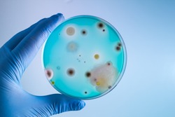 Hands of doctor with petri plate in the laboratory / technician with bacterias sample in petri dish