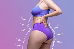 Buttocks, hip, abdomen liposuction, fat and cellulite removal concept, overweight female body with painted surgical lines and arrows on a purple background with a gradient