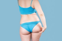 Overweight thigh, woman with fat hips and buttocks, obesity female body with cellulite on blue background, studio shot