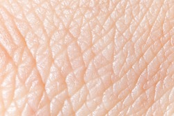 Human skin super macro texture.