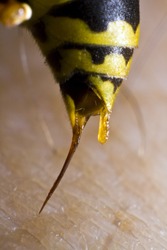 back of wasp in closeup while stinging a human