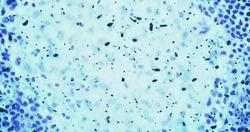 bacteria or germs microorganism cells under microscope in the color chemical blue fluid, slowing movement