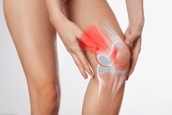 Knee meniscus inflamed, human leg, medically accurate representation of an arthritic knee joint	