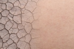 close-up on dry woman skin texture with dry soil