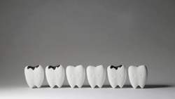  Decayed tooth model and some tooth start to decayed tooth  