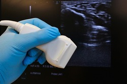 Linear ultrasound diagnostic probe held in doctor hand in blue glove, B-mode structure of wrist and median nerve for carpal tunnel syndrome diagnostics in background.