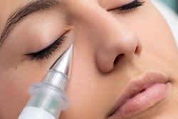 Macro close up of woman having noninvasive cosmetic facial with plasma pen. Cone shaped device doing skin tightening under eye.