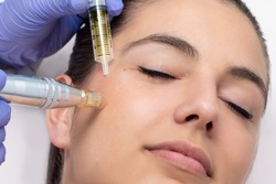 Close up of young woman having cosmetic mesotherapy facial. Therapist injecting pharmaceuticals with derma pen on cheek.