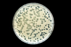 petri dish with bacterial culture with phace activity - plaque