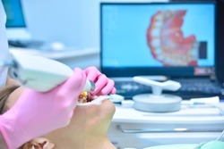 Dentist hands scaning patient's teeth with dental 3d scanner and laptop screen with 3d scanning of jaw. Healthcare and stomatology concept
