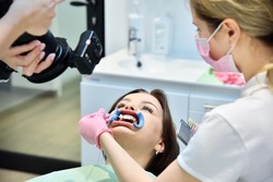 Dentist woman photographing teeth before teeth whitening procedure. Dental And Teeth Whitening Concept. Close up