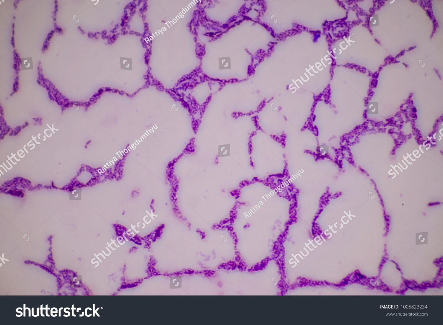 spirilla bacteria under microscope