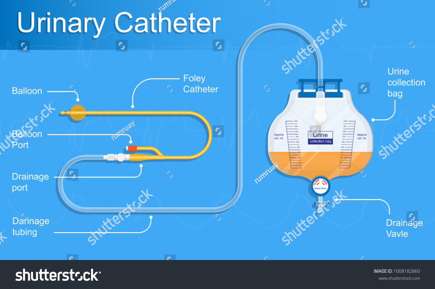 Urine Bag Medical Treatment Drainage Bladder Stock Vector (Royalty Free ...