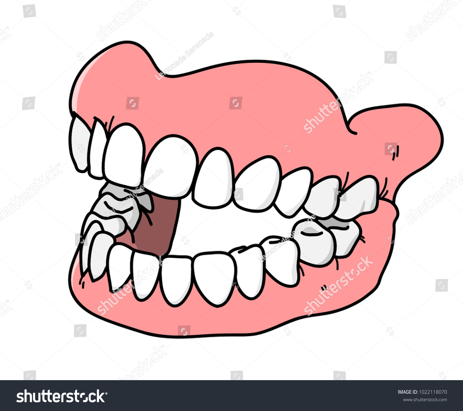 Вставные зубы рисунок