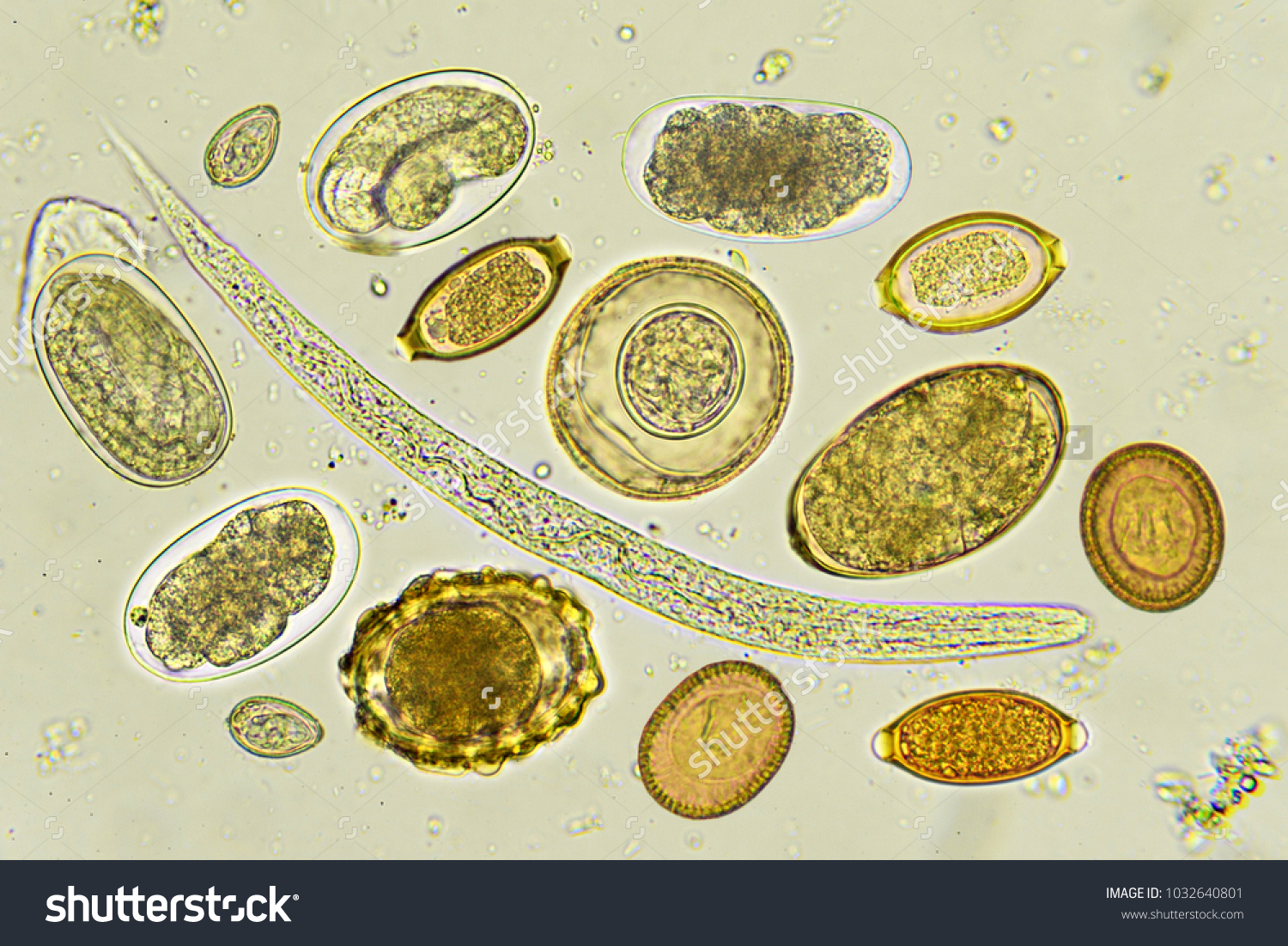 Яйца гельминтов под микроскопом стронгилоидоз