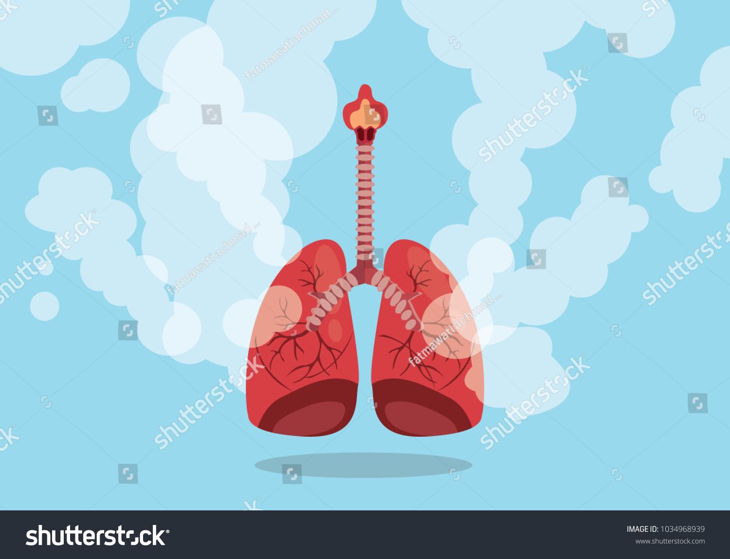 Lungs On Smoke Unhealthy Sign Flat Stock Vector (Royalty Free ...