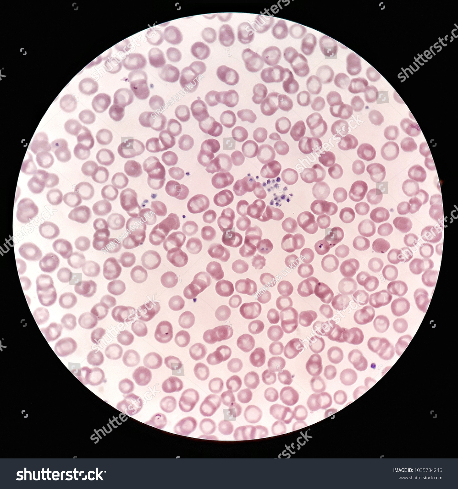 Human Blood Smear Under 100x Light Stock Photo 1035784246 | Shutterstock