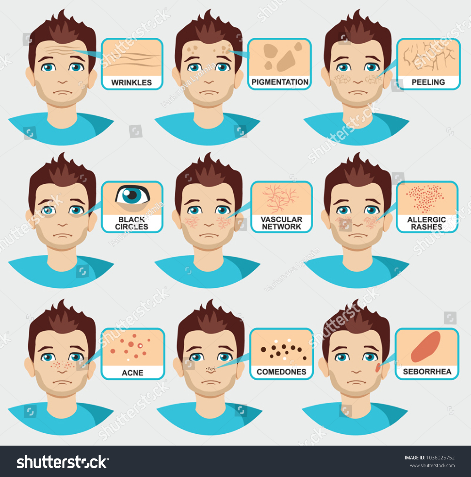 Man Skin Problems Vector Illustration Male Stock Vector (Royalty Free ...