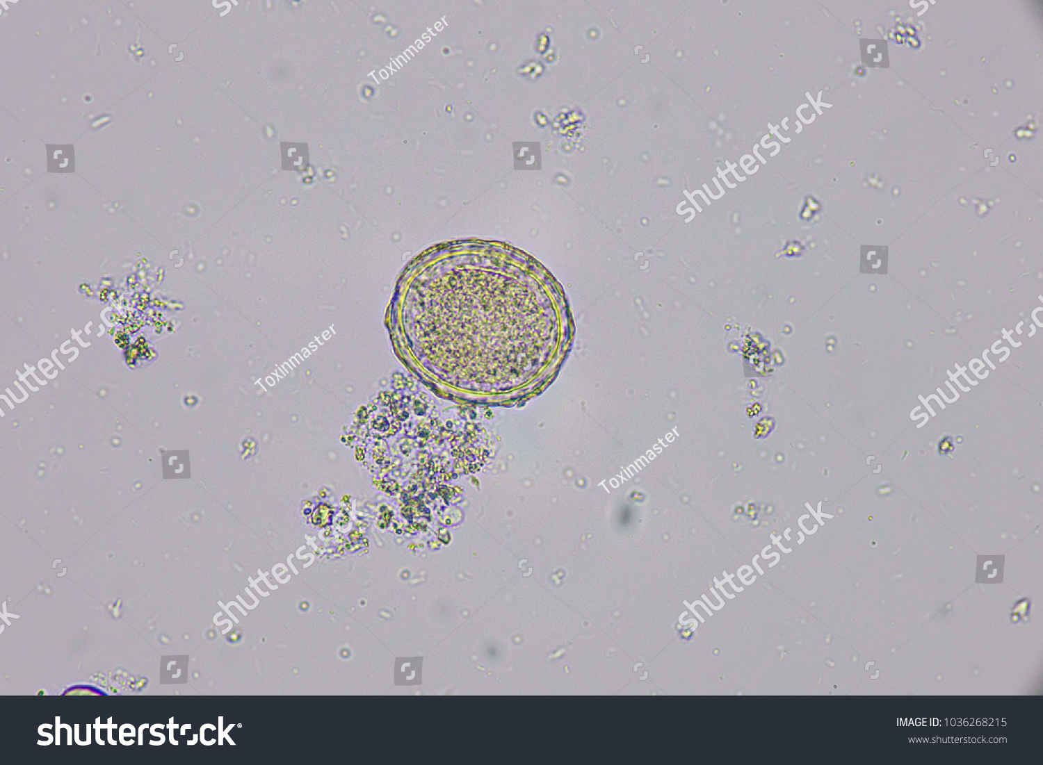 Ascaris Lumbricoides Fertilized Egg Parasite Ground Stock Photo ...