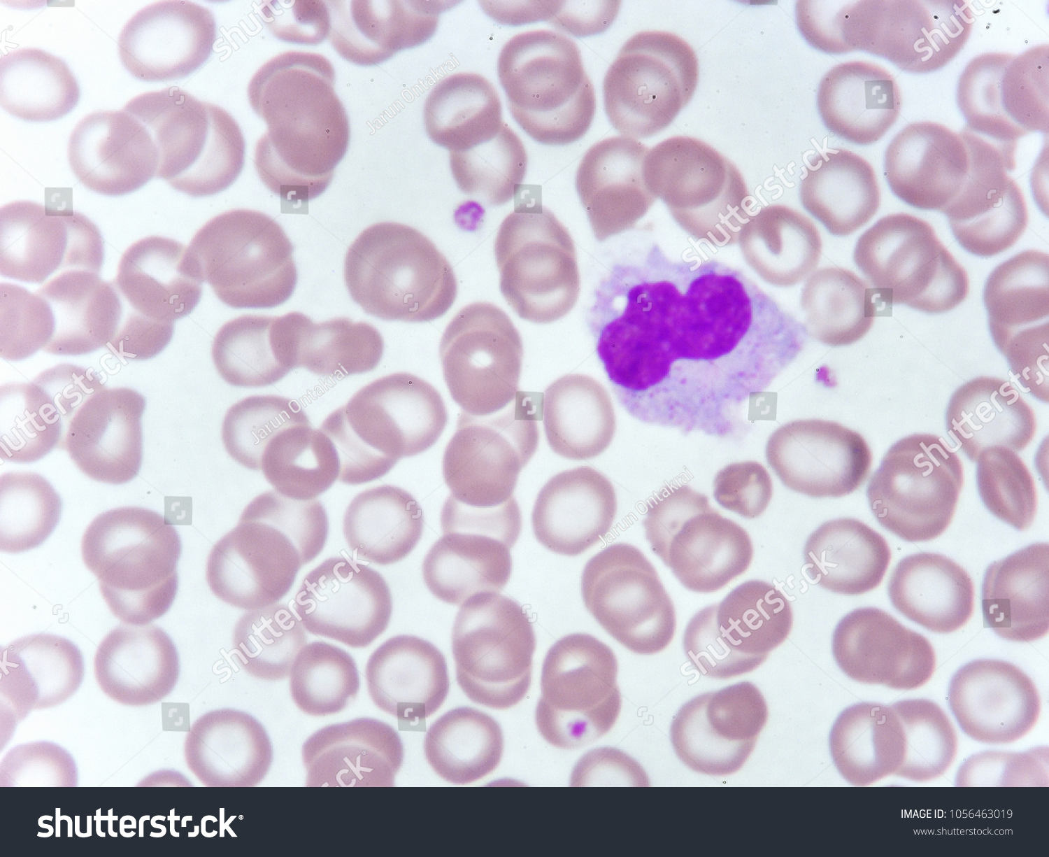 Monocyte White Blood Blood Stock Photo 1056463019 | Shutterstock
