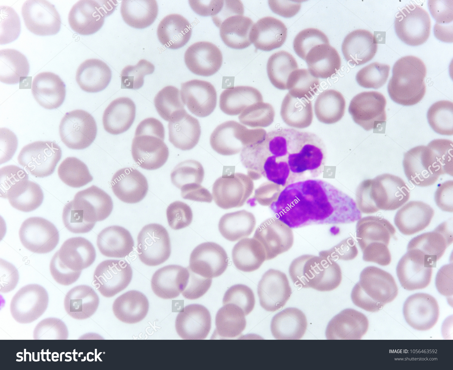 Monocyte Neutrophil Cell Blood Smear Stock Photo | Shutterstock